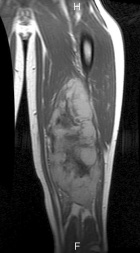 Zoom image: Radiological image