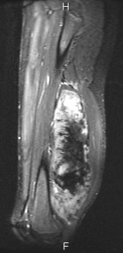 Zoom image: Radiological image