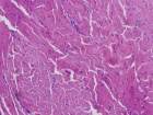Zoom image: Cell stain