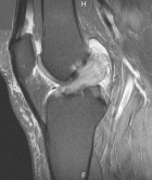 Zoom image: Radiological image