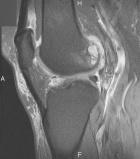 Zoom image: Radiological image