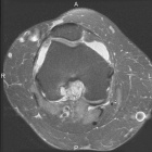 Zoom image: Radiological image