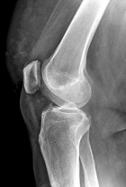 Zoom image: Radiological image