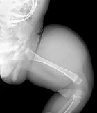 Zoom image: Radiological image