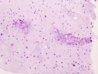 Zoom image: Cell stain