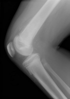 Zoom image: Radiological image