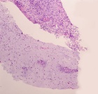 Zoom image: Cell stain