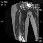 Zoom image: Radiological image