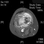 Zoom image: Radiological image