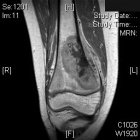 Zoom image: Radiological image