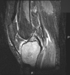Zoom image: Radiological image