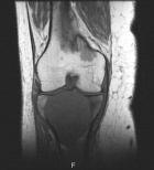 Zoom image: Radiological image