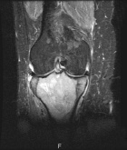 Zoom image: Radiological image