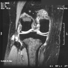Zoom image: Radiological image