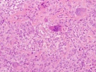 Zoom image: Cell stain