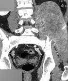 Zoom image: Radiological image