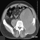 Zoom image: Radiological image