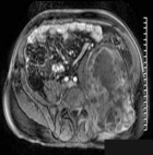 Zoom image: Radiological image