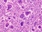 Zoom image: Cell stain