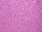 Zoom image: Cell stain