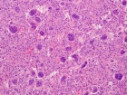 Zoom image: Cell stain