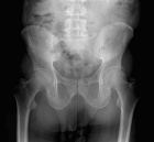 Zoom image: Radiological image