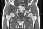Zoom image: Radiological image