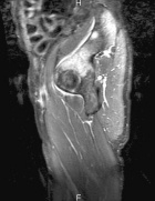 Zoom image: Radiological image