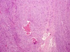 Zoom image: Cell stain
