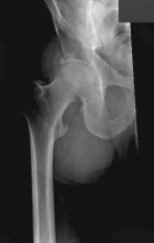 Zoom image: Radiological image