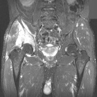 Zoom image: Radiological image