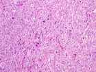 Zoom image: Cell stain