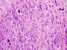 Zoom image: Cell stain
