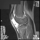 Zoom image: Radiological image