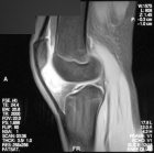 Zoom image: Radiological image