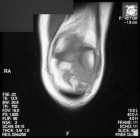 Zoom image: Radiological image