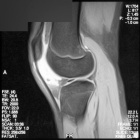 Zoom image: Radiological image