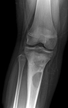 Zoom image: Radiological image