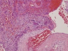 Zoom image: Cell stain