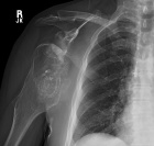 Zoom image: Radiological image