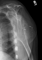 Zoom image: Radiological image