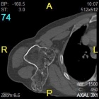 Zoom image: Radiological image