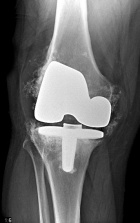 Zoom image: Radiological image