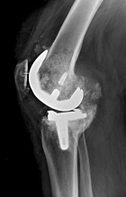 Zoom image: Radiological image