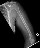 Zoom image: Radiological image