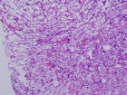 Zoom image: Cell stain