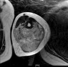 Zoom image: Radiological image