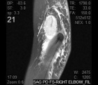 Zoom image: Radiological image