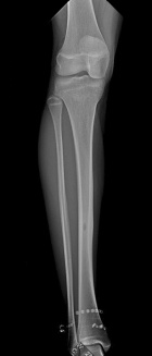 Zoom image: Radiological image