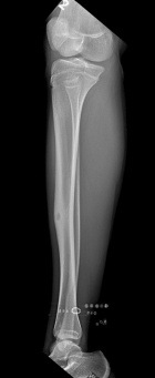 Zoom image: Radiological image